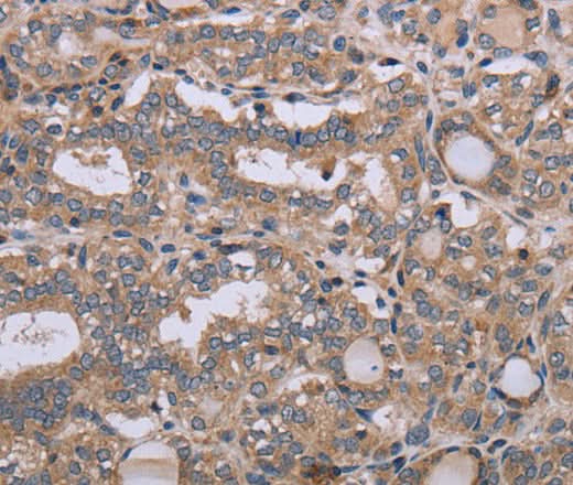 Anti-Human NAA25 Antibody - ABMIUM
