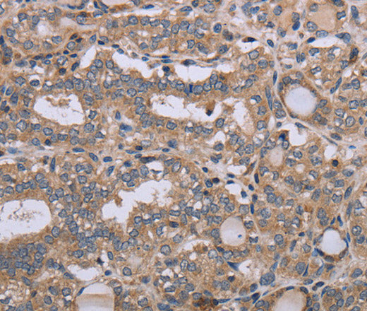 Anti-Human NAA25 Antibody - ABMIUM