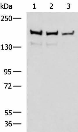 Western blot analysis of Mouse brain tissue Rat brain tissue and HepG2 cell lysates using ROCK2 Polyclonal Antibody at dilution of 1:400