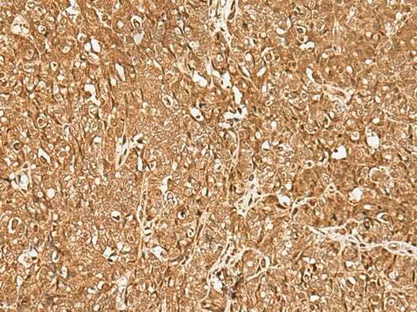 Anti-Human/Mouse/Rat GMEB2 Antibody
