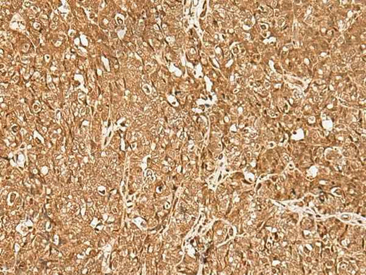 Anti-Human/Mouse/Rat GMEB2 Antibody