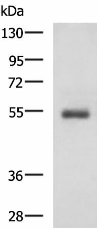 Western blot analysis of Human 2-3 grade invasive ductal breast tissue lysate using RHCG Polyclonal Antibody at dilution of 1:600