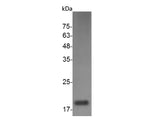 Recombinant Mouse M-CSF protein(His Tag) - ABMIUM