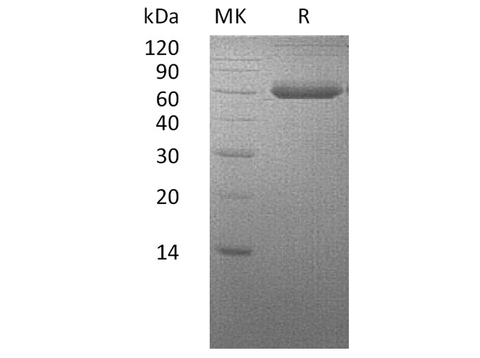 Recombinant Human BMPRIA/ALK-3 Protein (Fc & His Tag) - ABMIUM