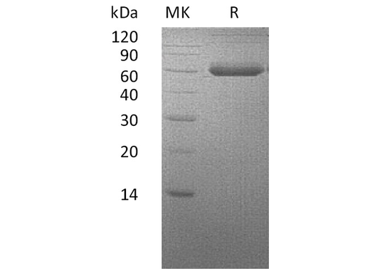 Recombinant Human BMPRIA/ALK-3 Protein (Fc & His Tag) - ABMIUM