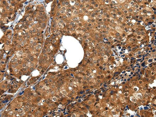 Anti-Human ZBTB2 Antibody - ABMIUM
