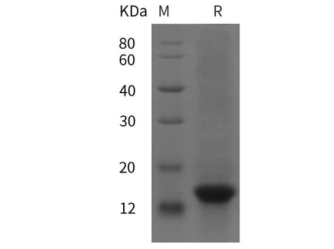 SDS-PAGE analysis of Human BDNF proteins, 2 μg/lane of Recombinant Human BDNF proteins was resolved with SDS-PAGE under reducing conditions, showing bands at 15 kDa.