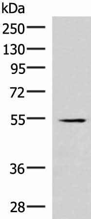 Anti-Human/Mouse IRX1 Antibody