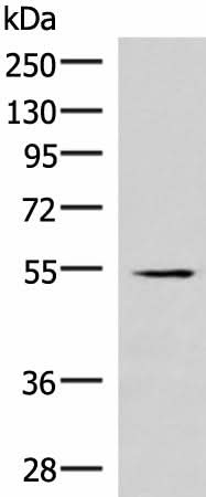 Western blot analysis of Human heart tissue lysate using IRX1 Polyclonal Antibody at dilution of 1:300