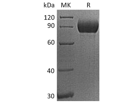 Recombinant Human CD155/PVR/NECL5 Protein (Fc Tag) - ABMIUM