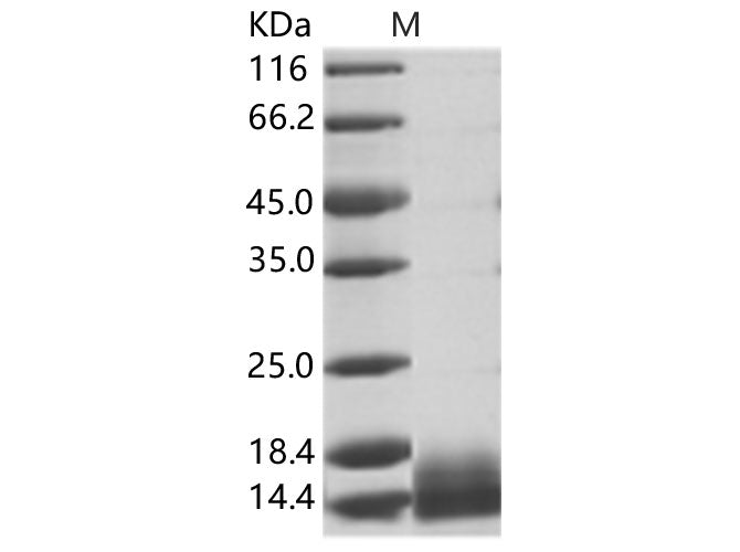 Recombinant WNV (lineage 1, strain NY99) E / Envelope Protein (Domain III, His Tag) - ABMIUM