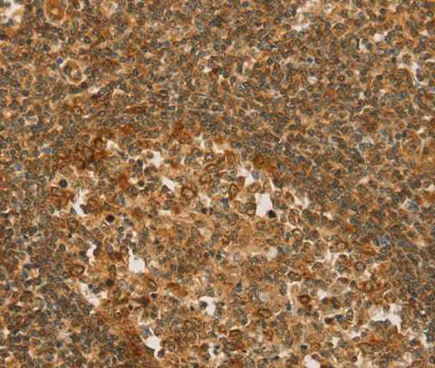 Anti-Human/Mouse/Rat SLC6A3 Antibody