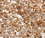 Anti-Human/Mouse/Rat SLC9A3R2 Antibody - ABMIUM