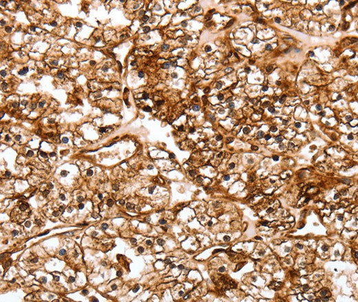 Anti-Human/Mouse/Rat SLC9A3R2 Antibody - ABMIUM