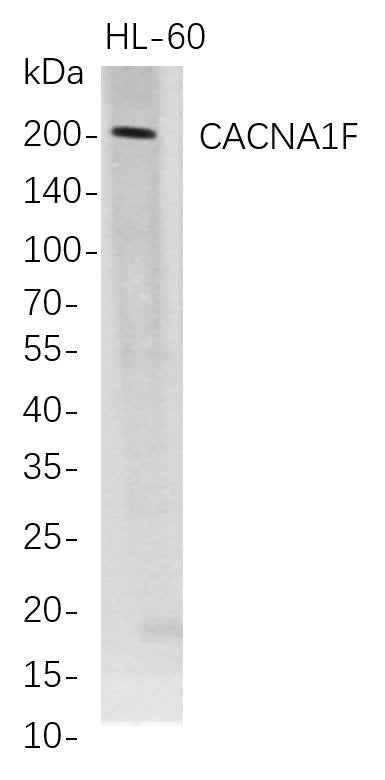 Anti-Human CACNA1F Antibody [B682] - ABMIUM