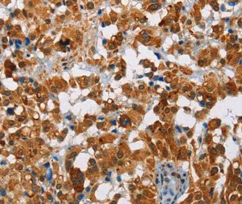 Anti-Human/Mouse/Rat ATXN1 Antibody