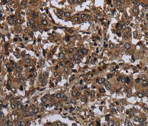 Anti-Human GLIPR1 Antibody