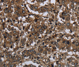 Anti-Human GLIPR1 Antibody - ABMIUM