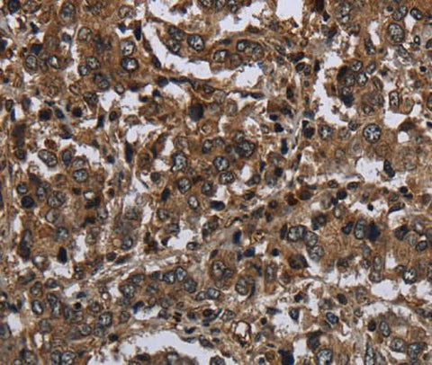 Anti-Human GLIPR1 Antibody - ABMIUM