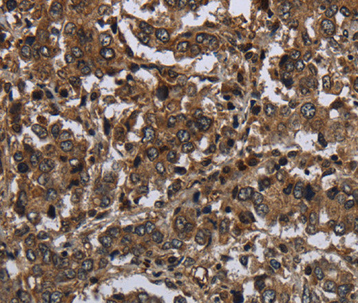 Anti-Human GLIPR1 Antibody - ABMIUM