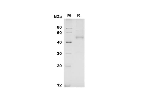SDS-PAGE analysis of Mouse NOV/CCN3 proteins, 2 μg/lane of Recombinant Mouse NOV/CCN3 proteins was resolved with SDS-PAGE under reducing conditions, showing bands at 50 kDa.