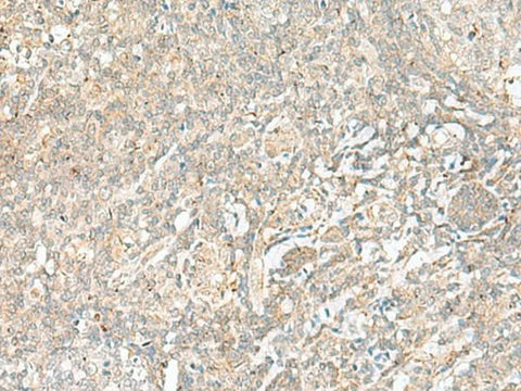 Immunohistochemistry of paraffin-embedded Human tonsil tissue using BEX2 Polyclonal Antibody at dilution of 1:45(×200)