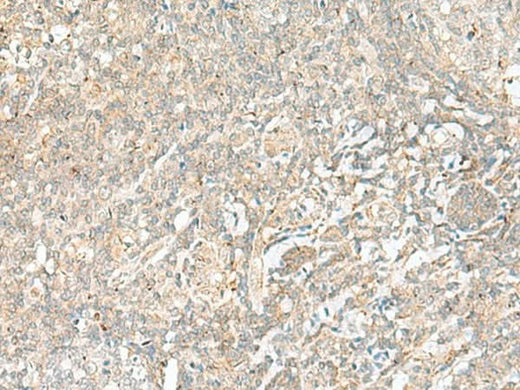Immunohistochemistry of paraffin-embedded Human tonsil tissue using BEX2 Polyclonal Antibody at dilution of 1:45(×200)