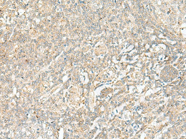 Immunohistochemistry of paraffin-embedded Human tonsil tissue using BEX2 Polyclonal Antibody at dilution of 1:45(×200)