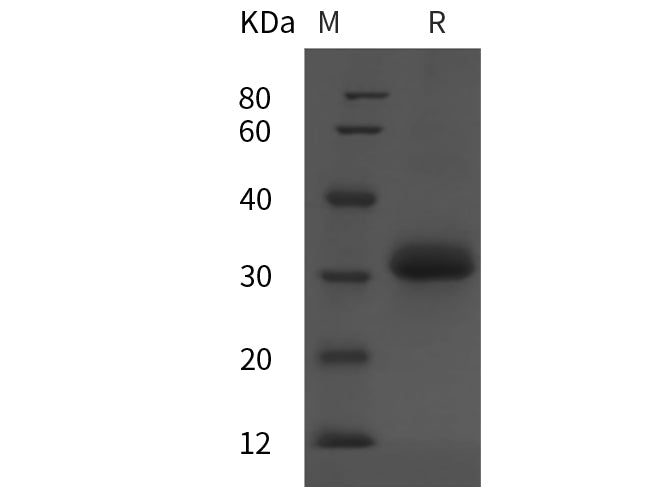 SDS-PAGE analysis of Human IGFBP-7 proteins, 2 μg/lane of Recombinant Human IGFBP-7 proteins was resolved with SDS-PAGE under reducing conditions, showing bands at 32 kDa.