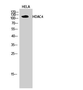 Western Blot analysis of Hela cells using HDAC4 Polyclonal Antibody at dilution of 1:2000.