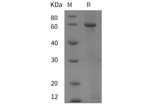 SDS-PAGE analysis of Rat Amine oxidase A/MAOA proteins, 2 μg/lane of Recombinant Rat Amine oxidase A/MAOA proteins was resolved with SDS-PAGE under reducing conditions, showing bands at 60 kDa.