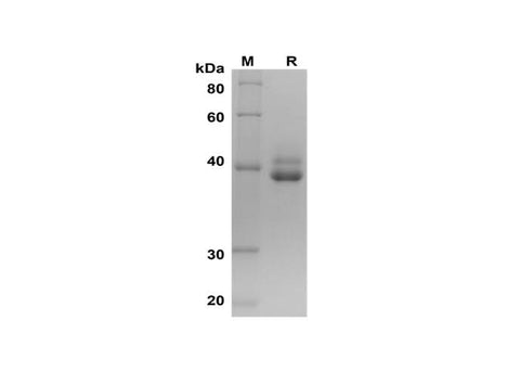 SDS-PAGE analysis of Human IL12(P40) proteins, 2 μg/lane of Recombinant Human IL12(P40) proteins was resolved with SDS-PAGE under reducing conditions, showing bands at 38-42 kDa.
