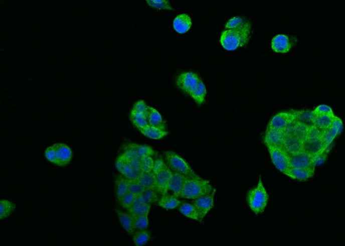 Anti-Human TNFRSF10B Antibody [A893] - ABMIUM