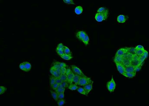 Anti-Human TNFRSF10B Antibody [A893] - ABMIUM
