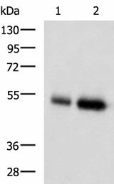 Anti-Human/Mouse BMP5 Antibody - ABMIUM