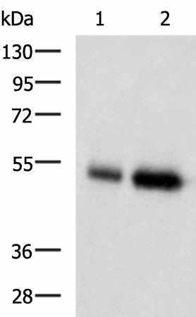 Anti-Human/Mouse BMP5 Antibody - ABMIUM