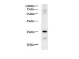 Western blot of Zebrafish whole lysates with anti-PCNA pAb at dilution of 1:1000.