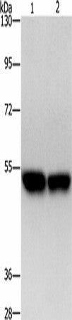 Anti-Human ZFYVE19 Antibody - ABMIUM