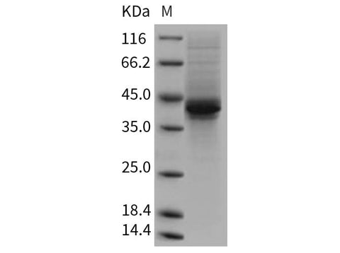> 85 % as determined by reducing SDS-PAGE.