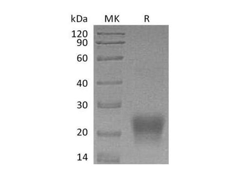 Recombinant Human Tetherin/BST2 Protein (His Tag) - ABMIUM