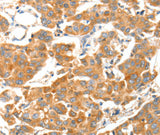 Anti-Human/Mouse ADAMTS18 Antibody - ABMIUM