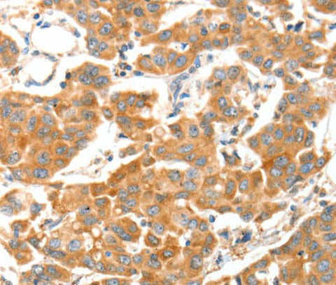 Anti-Human/Mouse ADAMTS18 Antibody - ABMIUM