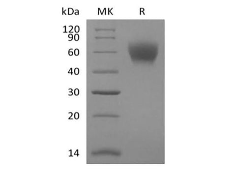 Recombinant Mouse TPBG/5T4 (C-6His) - ABMIUM