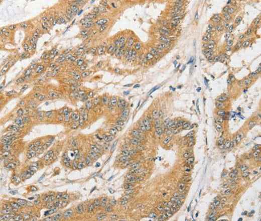 Anti-Human/Mouse/Rat ATG5 Antibody