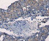 Anti-Human/Mouse/Rat FGF2 Antibody - ABMIUM