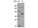 SDS-PAGE analysis of Human CDK2 proteins, 2 μg/lane of Recombinant Human CDK2 proteins was resolved with SDS-PAGE under reducing conditions, showing bands at 34 kDa.