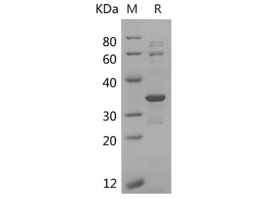 SDS-PAGE analysis of Human CDK2 proteins, 2 μg/lane of Recombinant Human CDK2 proteins was resolved with SDS-PAGE under reducing conditions, showing bands at 34 kDa.