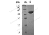 Recombinant Human Fumarylacetoacetase/FAH Protein (His Tag) - ABMIUM