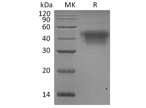 Recombinant Human CD16a/FCGR3A Protein (His Tag) - ABMIUM