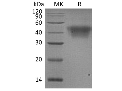 Recombinant Human CD16a/FCGR3A Protein (His Tag) - ABMIUM